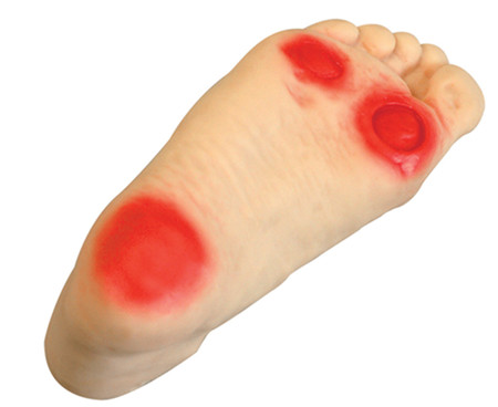 高級糖尿病足部護理模型